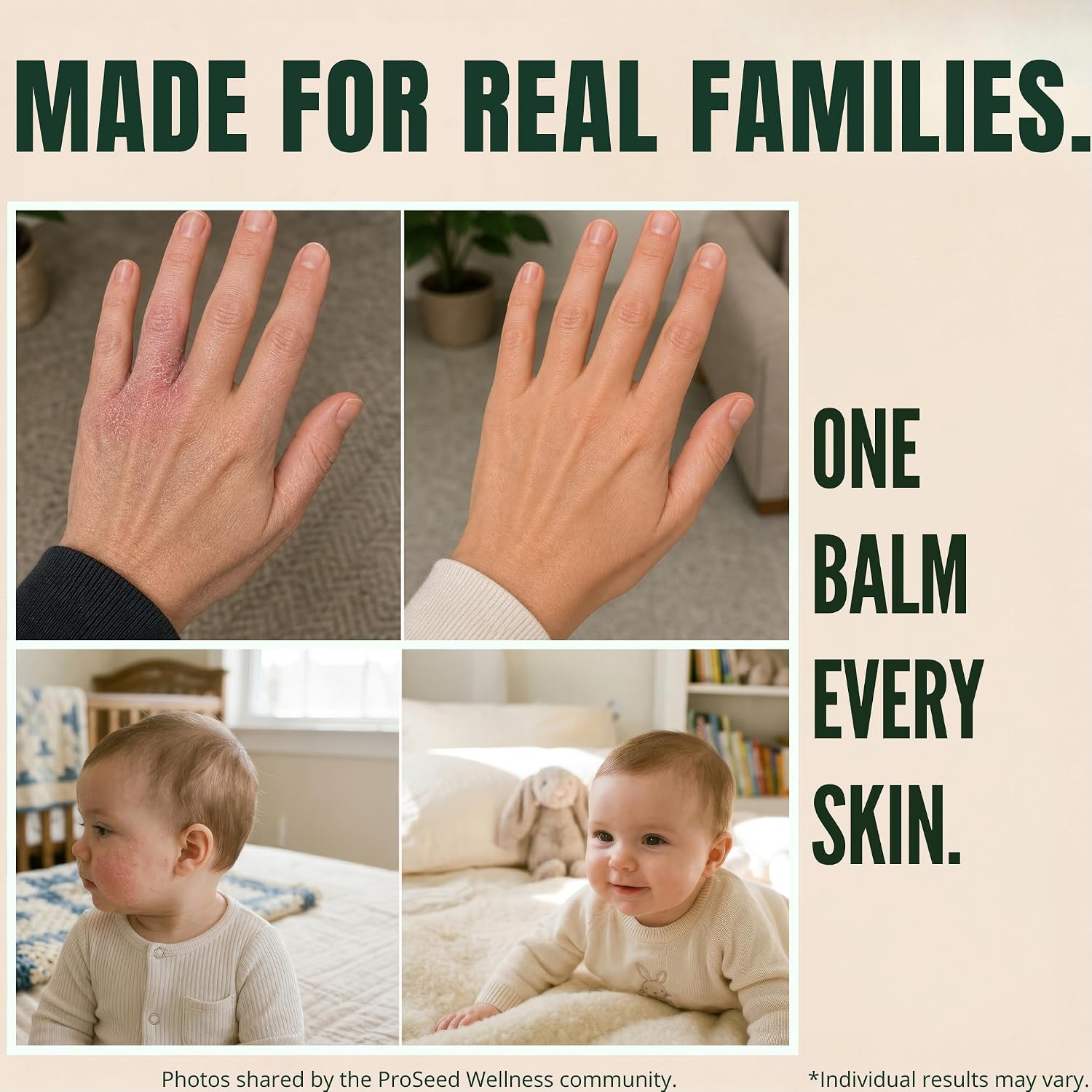 Beef Tallow for Skin, Face & Body Tallow Balm Deep Moisture for Dry Skin | Sensitive Skin, Made in USA, Holistic Wellness, Dry Skin Eczema, Psoriasis, Organic Tallow Moisturizer